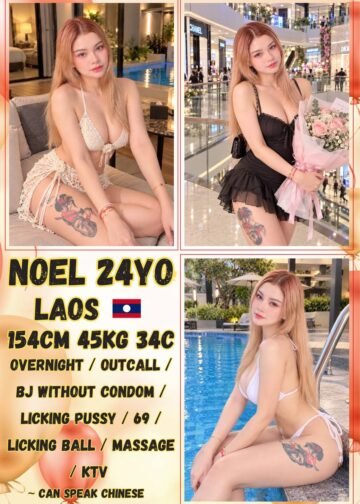 NOEL JB ESCORT