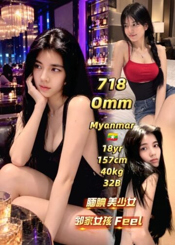 OMM JB ESCORT